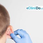 تجميل الأذن البارزة