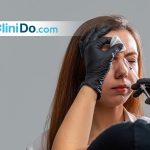 تعليمات بعد حقن البوتوكس