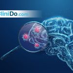 الالتهاب السحائي