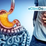 علاج ارتجاع المريء